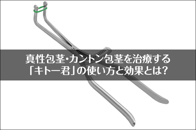 �^����s�E�J���g����s�����Â���u�L�g�[�N�v�̎g�����ƌ��ʂƂ́H