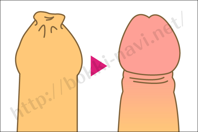 �^����s�E�J���g����s�����Â���u�L�g�[�N�v�̎g�����ƌ��ʂƂ́H